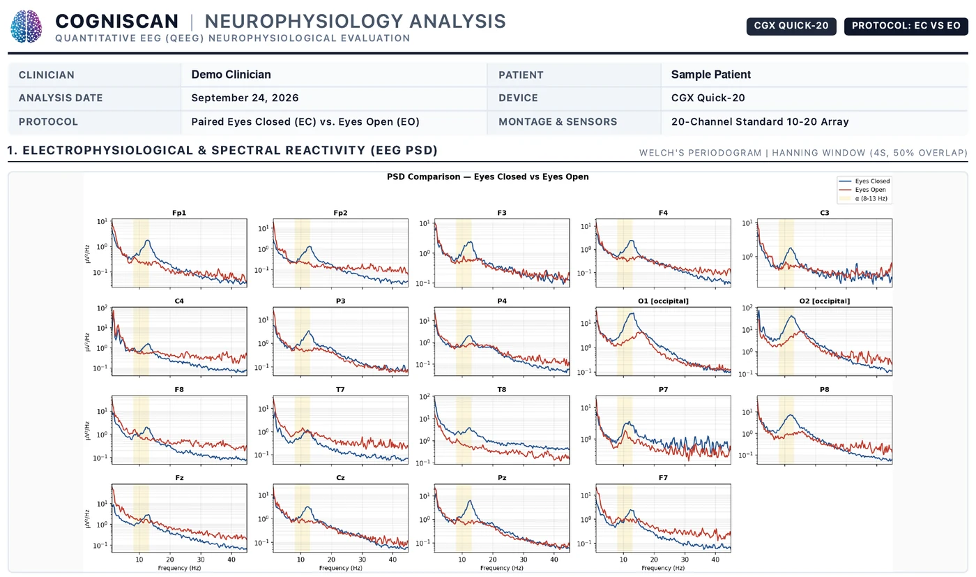 First page of a Cogniscan Neurophysiology Analysis report: session details and eyes-closed versus eyes-open power spectra for each of 20 EEG channels