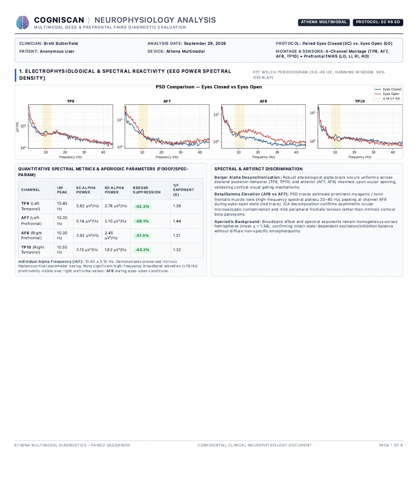 Report page 1: EEG power spectral density per channel, eyes closed versus eyes open, with a spectral metrics table